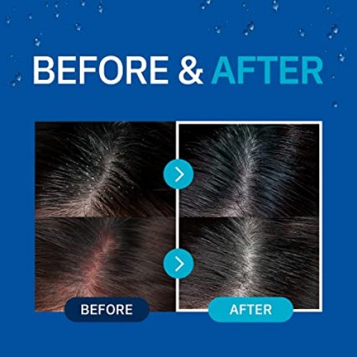 71j1padt69l._sx425_-1665074691-1677775821