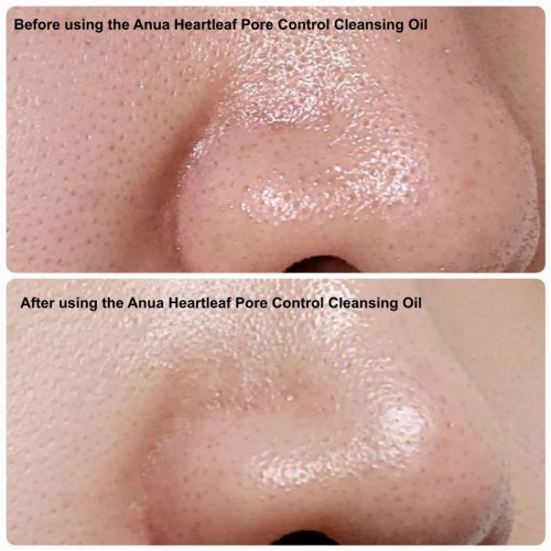 anua_heartleaf_pore_control_cleansing_oil_200_ml_kbeauty_australia_-_before_and_after__35702-1744789555